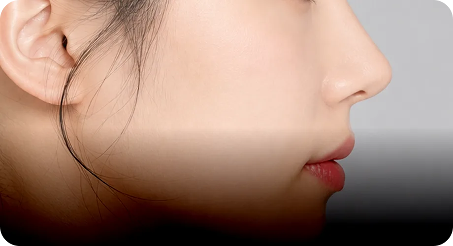 Subtle Profile Refinement