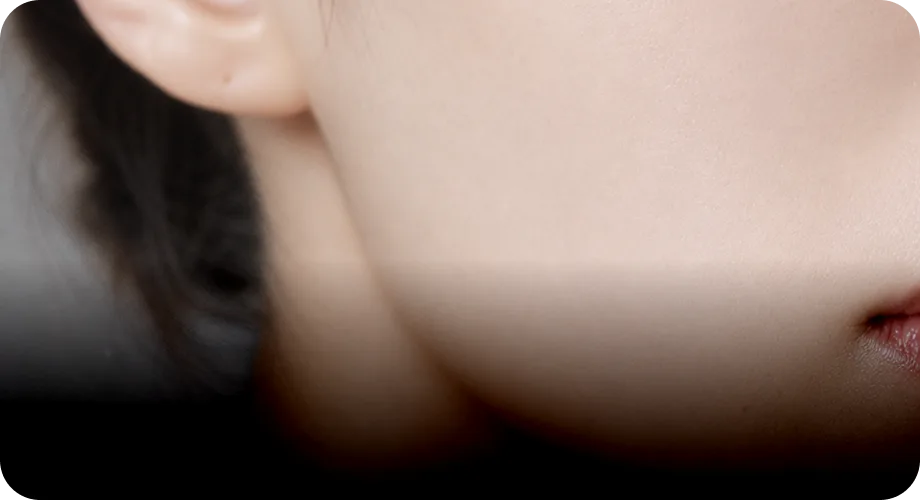 Fine Lines & Pores