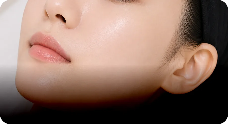 Fine Lines & Pores