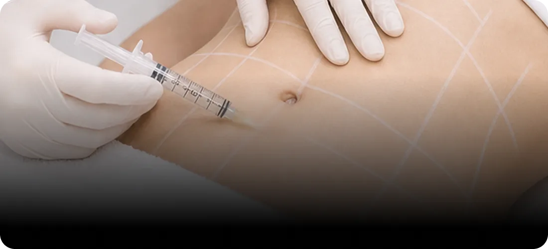 STEP 3. Precision Dermal Injection