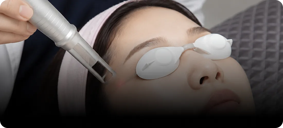STEP 3. Precision Dermal Injection