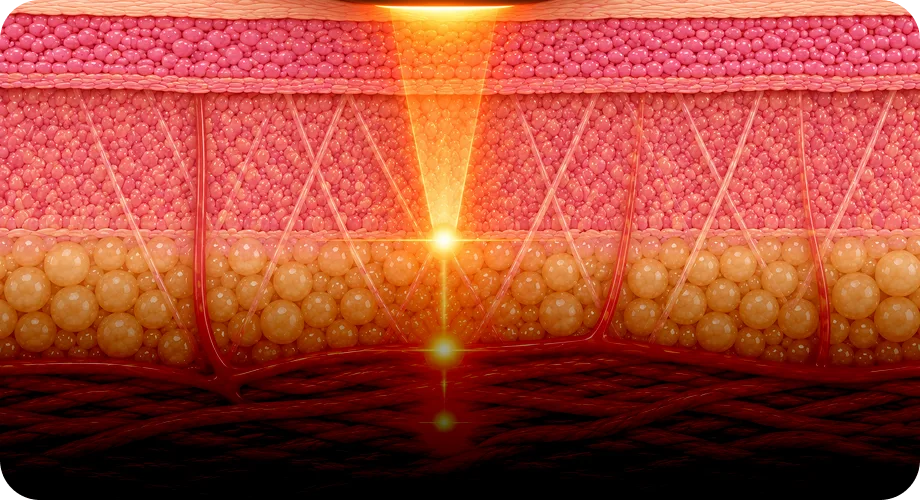 Layered Depth from Dermis to SMAS