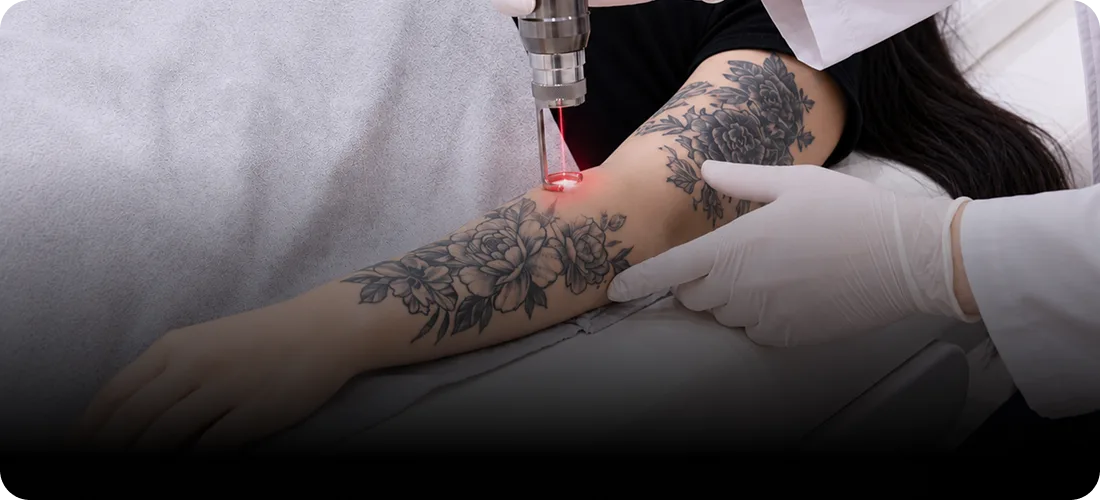 STEP 3. Precision Dermal Injection