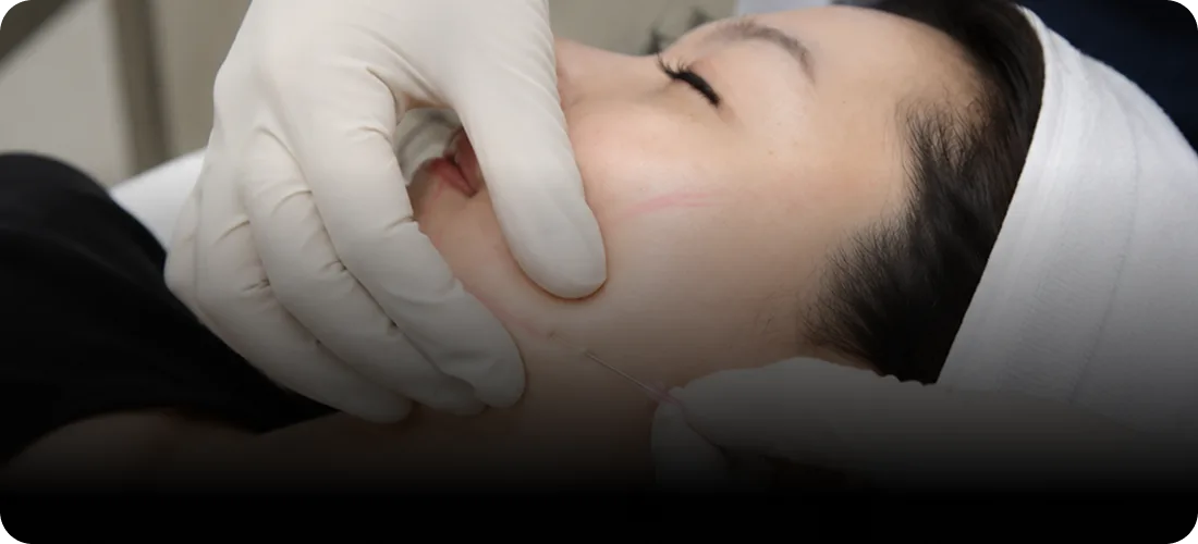 STEP 3. Precision Dermal Injection